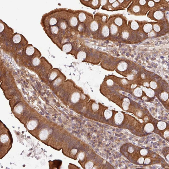 SHB Antibody in Immunohistochemistry (Paraffin) (IHC (P))
