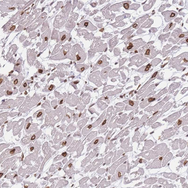 OR10AD1 Antibody in Immunohistochemistry (Paraffin) (IHC (P))
