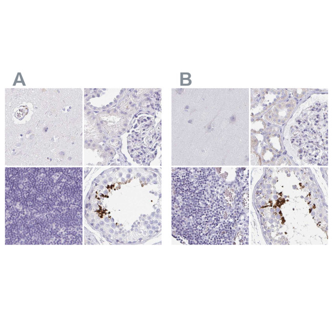 C2orf57 Antibody in Immunohistochemistry (IHC)