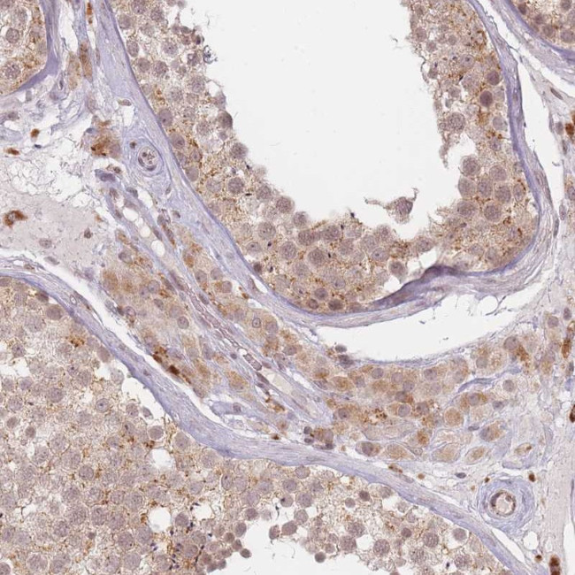 SPATA45 Antibody in Immunohistochemistry (Paraffin) (IHC (P))