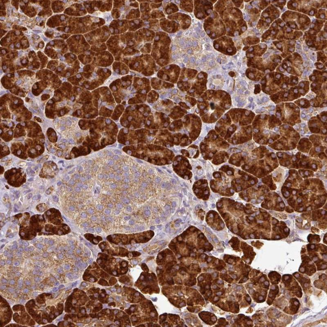 ANKRD18A Antibody in Immunohistochemistry (Paraffin) (IHC (P))