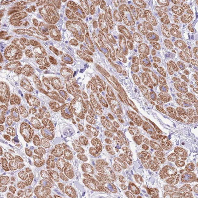 OR4Q3 Antibody in Immunohistochemistry (Paraffin) (IHC (P))