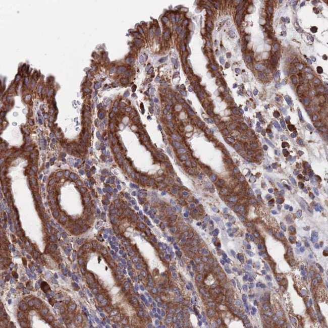 TWA1 Antibody in Immunohistochemistry (Paraffin) (IHC (P))