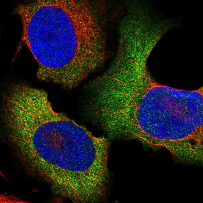 TCP-1 zeta Antibody in Immunocytochemistry (ICC/IF)