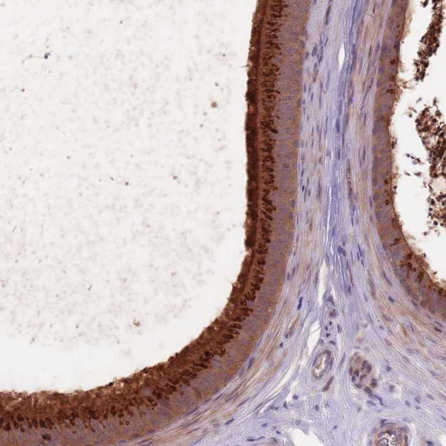 EDDM3A Antibody in Immunohistochemistry (Paraffin) (IHC (P))