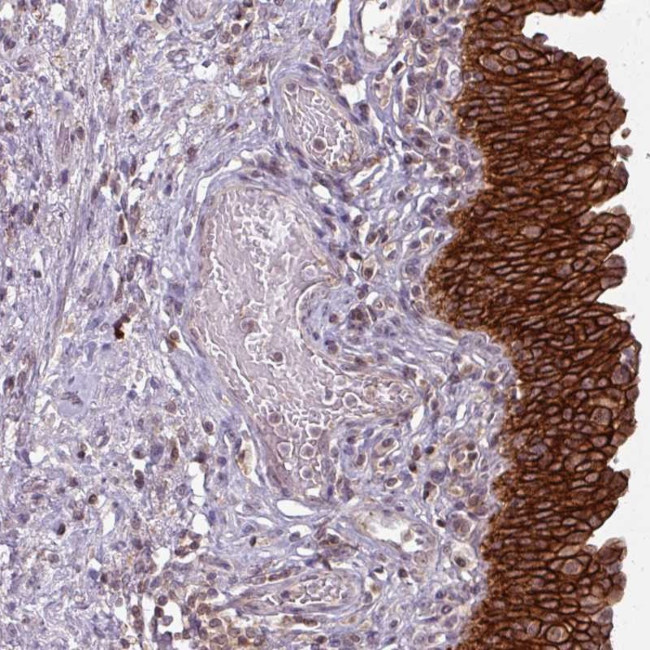 TUSC3 Antibody in Immunohistochemistry (Paraffin) (IHC (P))