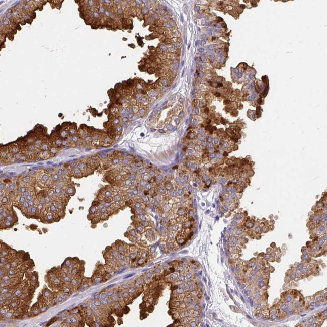 FAM83C Antibody in Immunohistochemistry (Paraffin) (IHC (P))