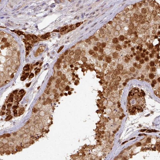 RANBP9 Antibody in Immunohistochemistry (Paraffin) (IHC (P))