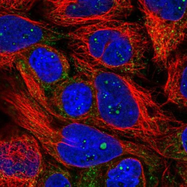 PXMP4 Antibody in Immunocytochemistry (ICC/IF)