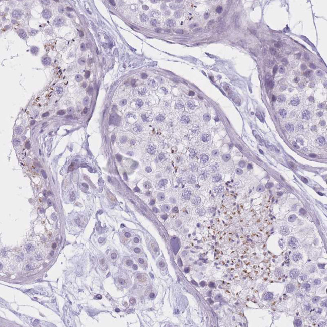 GOLGA6B Antibody in Immunohistochemistry (Paraffin) (IHC (P))