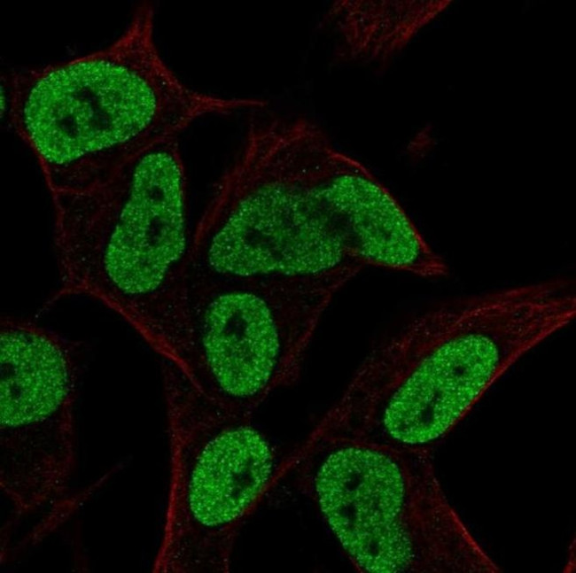 FAM182B Antibody in Immunocytochemistry (ICC/IF)