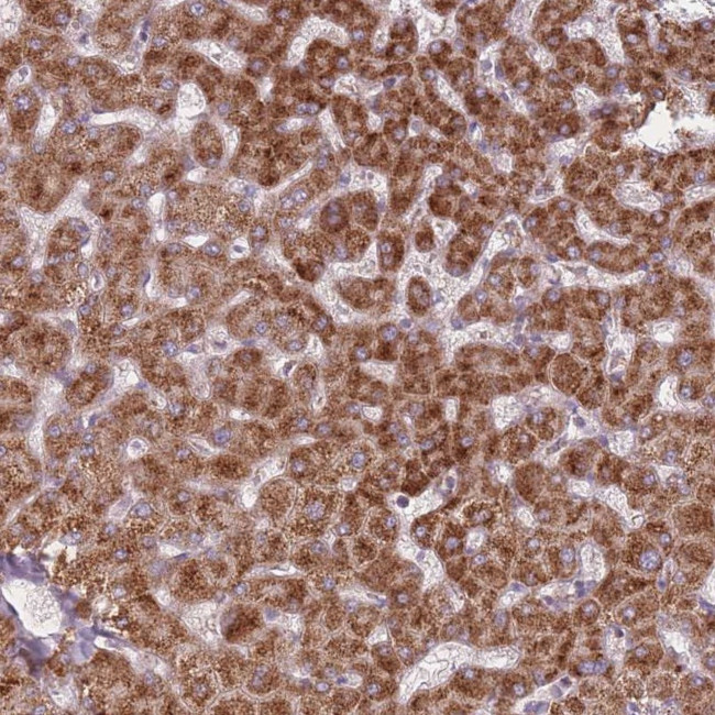 PEX11B Antibody in Immunohistochemistry (Paraffin) (IHC (P))