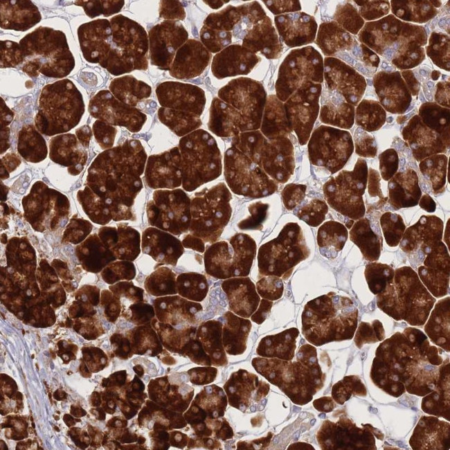 CACNG5 Antibody in Immunohistochemistry (Paraffin) (IHC (P))