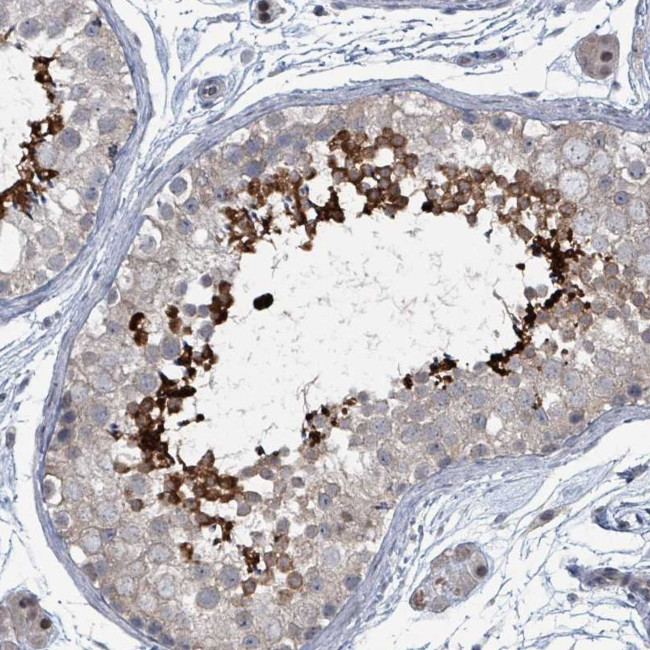 BIVM Antibody in Immunohistochemistry (Paraffin) (IHC (P))