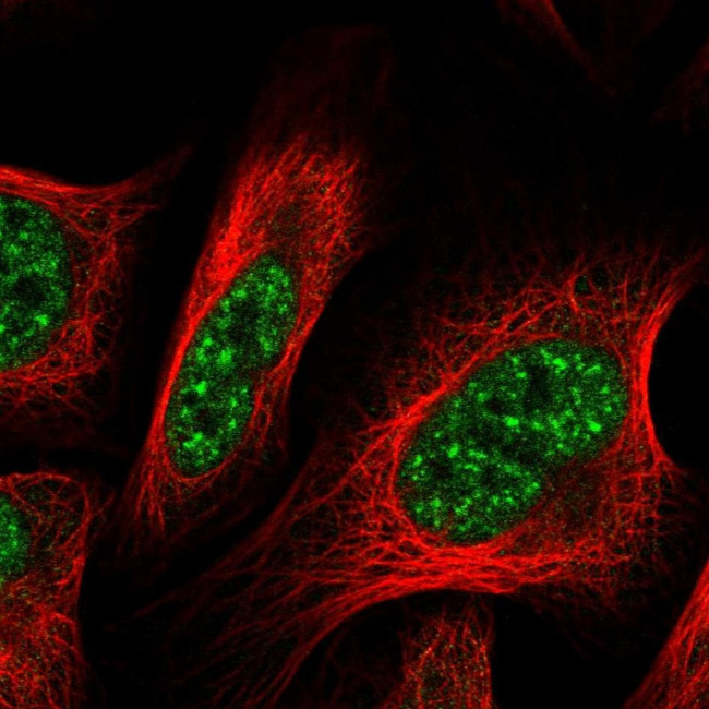 GLYR1 Antibody in Immunocytochemistry (ICC/IF)