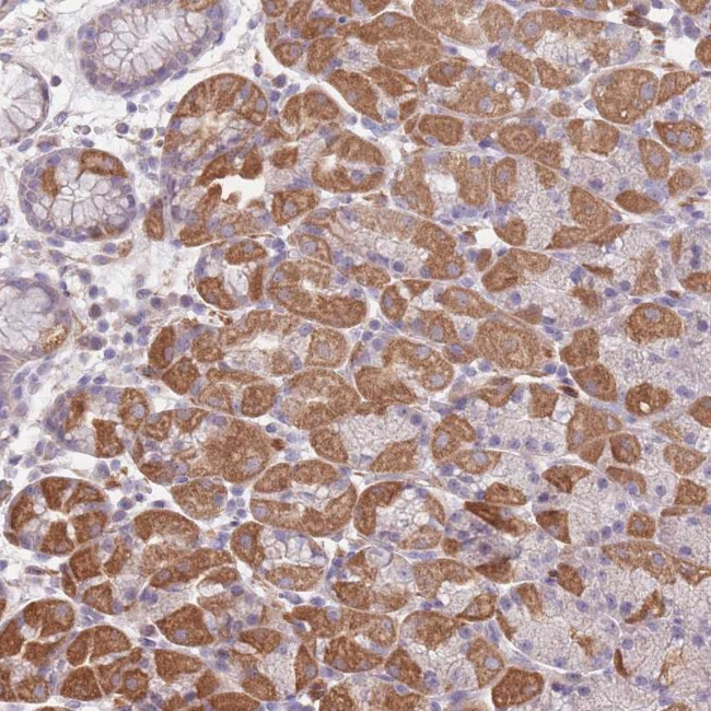 FAM58A Antibody in Immunohistochemistry (Paraffin) (IHC (P))