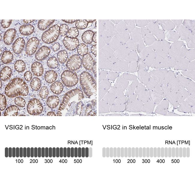 VSIG2 Antibody in Immunohistochemistry (Paraffin) (IHC (P))