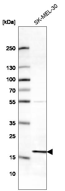 RPS18 Antibody in Western Blot (WB)