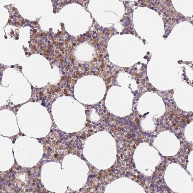 PRAM1 Antibody in Immunohistochemistry (Paraffin) (IHC (P))
