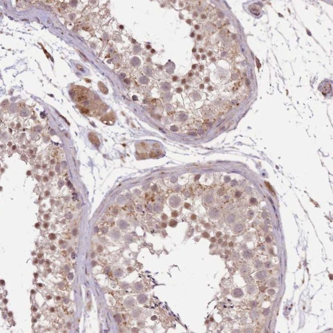 POLR3F Antibody in Immunohistochemistry (IHC)