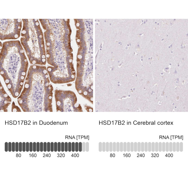 HSD17B2 Antibody in Immunohistochemistry (IHC)