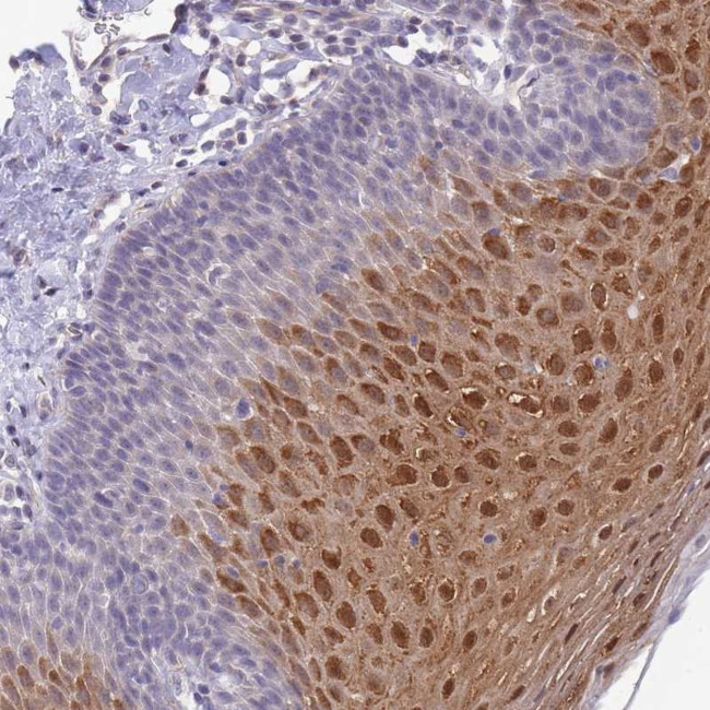 C19orf25 Antibody in Immunohistochemistry (Paraffin) (IHC (P))