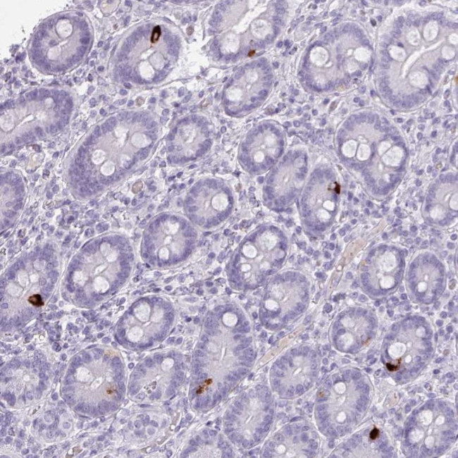 ZNF43 Antibody in Immunohistochemistry (Paraffin) (IHC (P))