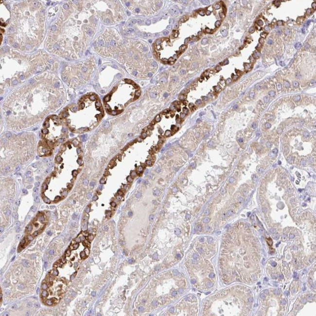 NT5C1A Antibody in Immunohistochemistry (Paraffin) (IHC (P))