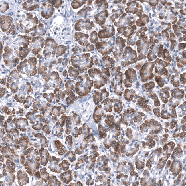 TMED5 Antibody in Immunohistochemistry (Paraffin) (IHC (P))