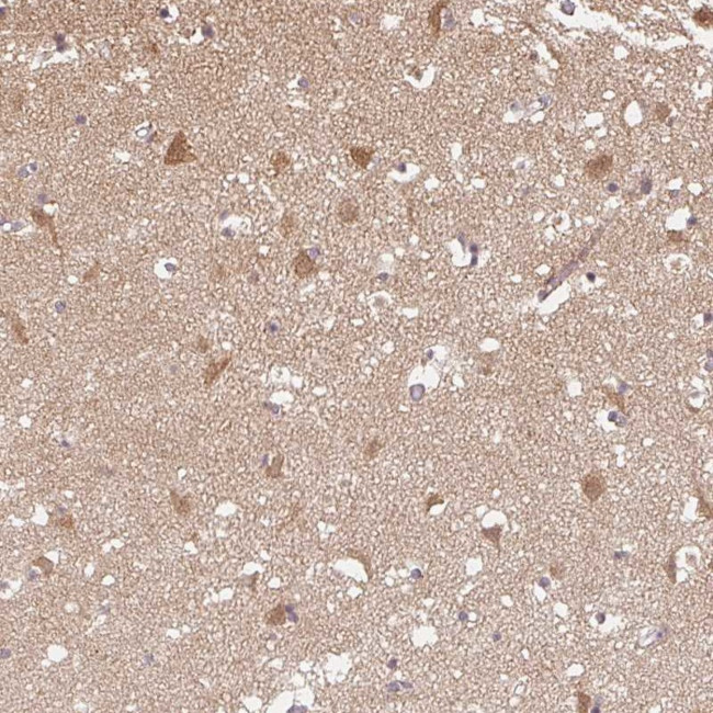 PPP4R4 Antibody in Immunohistochemistry (IHC)