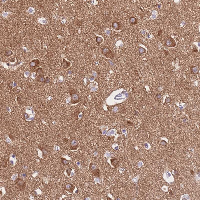 PPFIA3 Antibody in Immunohistochemistry (Paraffin) (IHC (P))