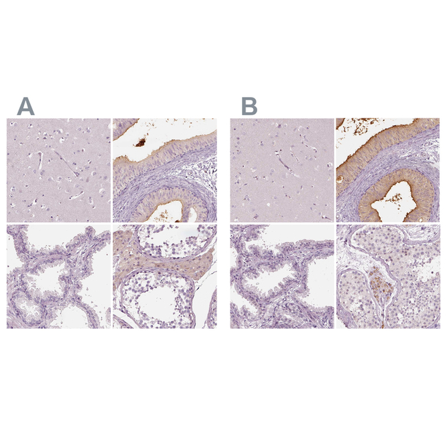 ELSPBP1 Antibody in Immunohistochemistry (Paraffin) (IHC (P))