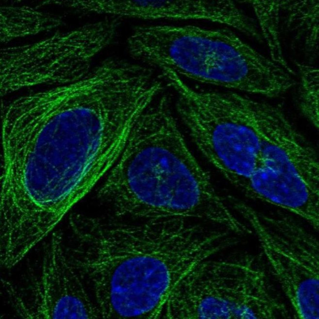 FBXL20 Antibody in Immunocytochemistry (ICC/IF)