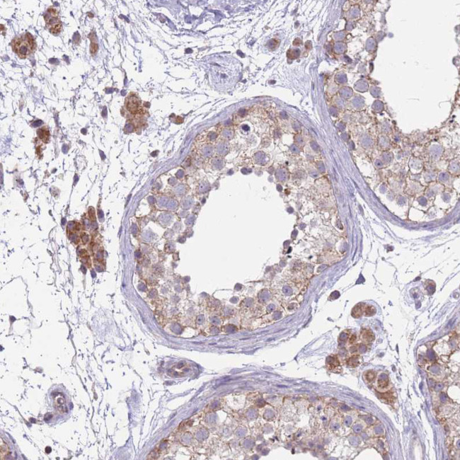 MRPS18C Antibody in Immunohistochemistry (Paraffin) (IHC (P))