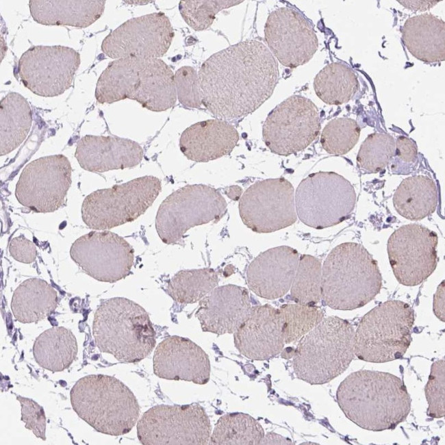 TMEM38A Antibody in Immunohistochemistry (Paraffin) (IHC (P))