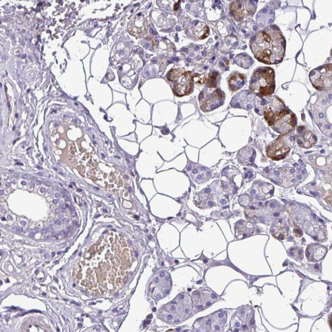 C11orf91 Antibody in Immunohistochemistry (Paraffin) (IHC (P))