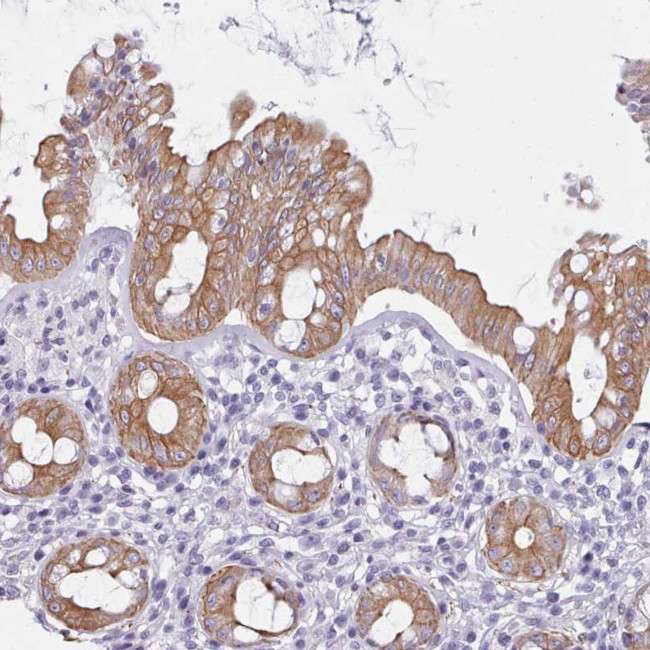 FPGS Antibody in Immunohistochemistry (Paraffin) (IHC (P))