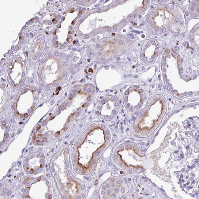 TMEM200C Antibody in Immunohistochemistry (Paraffin) (IHC (P))