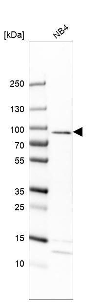 EPX Antibody in Western Blot (WB)