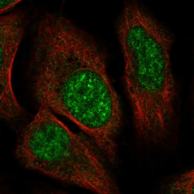 ZNF304 Antibody in Immunocytochemistry (ICC/IF)
