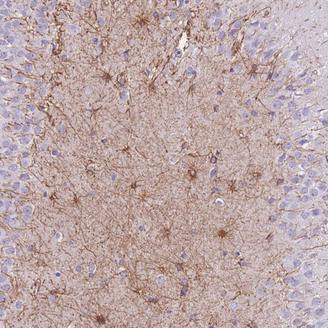 ZNF311 Antibody in Immunohistochemistry (Paraffin) (IHC (P))