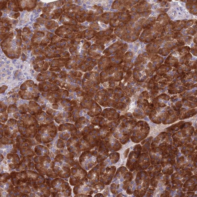 NDUFAF6 Antibody in Immunohistochemistry (Paraffin) (IHC (P))