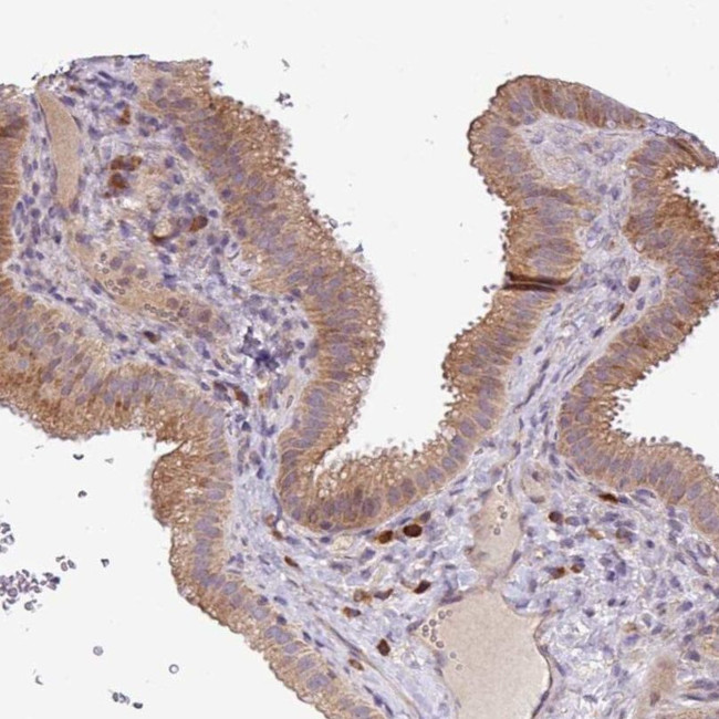TM2D2 Antibody in Immunohistochemistry (IHC)