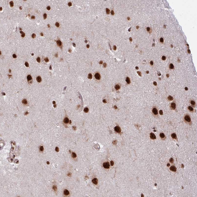 CHERP Antibody in Immunohistochemistry (Paraffin) (IHC (P))