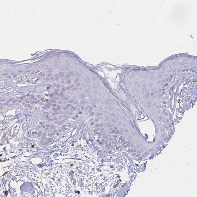 TTYH1 Antibody in Immunohistochemistry (Paraffin) (IHC (P))
