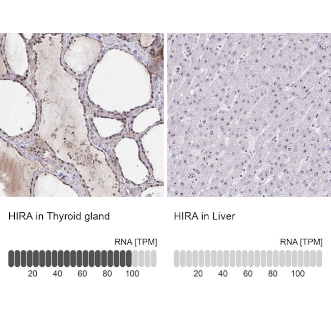 HIRA Antibody in Immunohistochemistry (IHC)