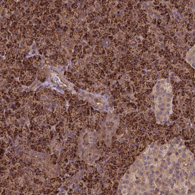 ZMYND19 Antibody in Immunohistochemistry (Paraffin) (IHC (P))