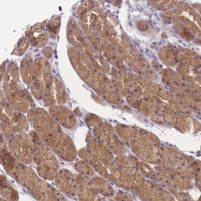 FAM84B Antibody in Immunohistochemistry (Paraffin) (IHC (P))