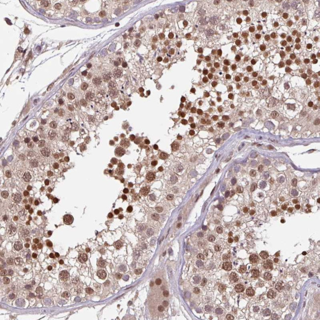 DR1 Antibody in Immunohistochemistry (Paraffin) (IHC (P))