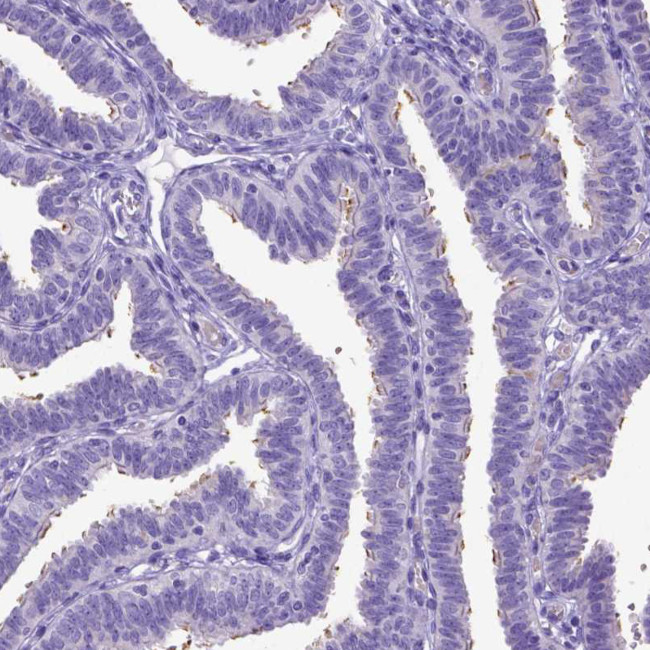 SPEF1 Antibody in Immunohistochemistry (Paraffin) (IHC (P))